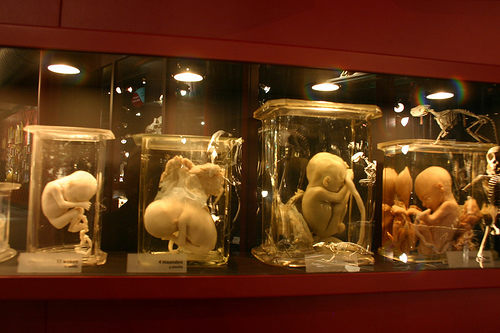 bao-tang-bo-phan-nguoi